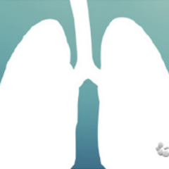 Personalizing risk assessment and treatment decisions in lung cancer.