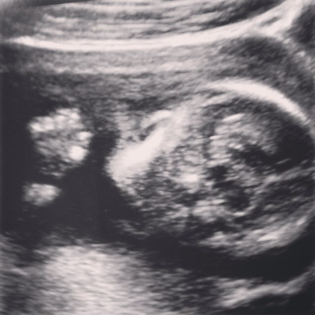 allysonmarie20's profile picture. have learned a lot in the past year, right where I'm supposed to be