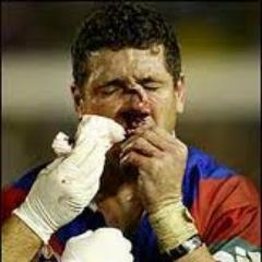 upload your game day warwounds for a retweet