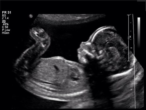 Mommy is @EloanorateSwan Daddy is @EM_Cullen born on August 31st