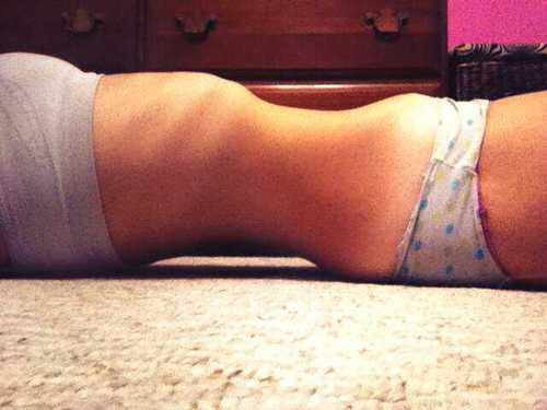 Relaped Anorexic.