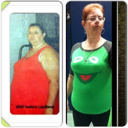 banded Nov 2007 trying to stay motivated and informed. conversion to gastric bypass in March 2021.
