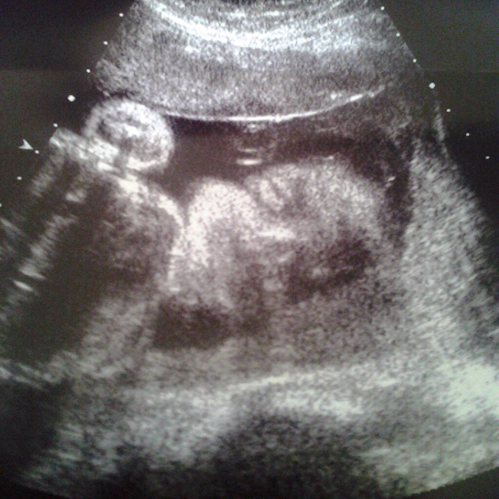 •New account , Follow me I Follow back.  Proud exspecting Mother Grinding for our future