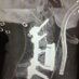 Paul Kraemer MD (@pk_spine) Twitter profile photo Paul Kraemer MD (@pk_spine) Twitter profile photo