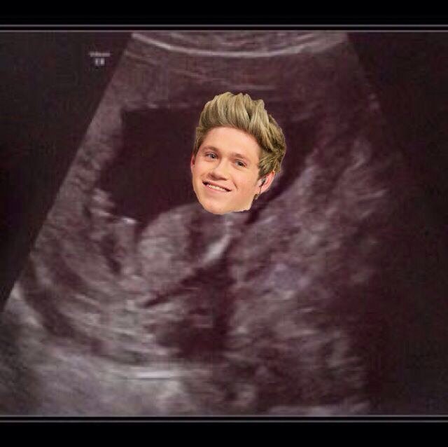 Niall and Harry are my daddies. Whats the craic?