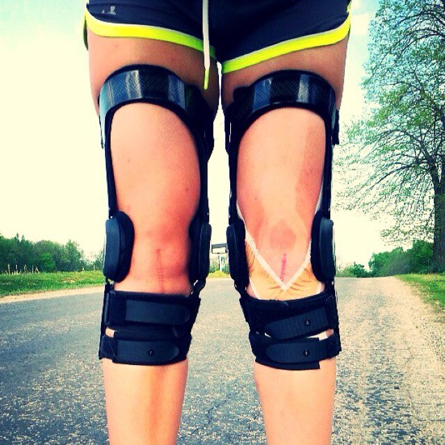ACLDiaries's profile picture. College & WPSL athlete who's torn both her ACLs! #ACLstrong