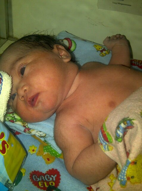 Ingin jlni hdp lbh baik