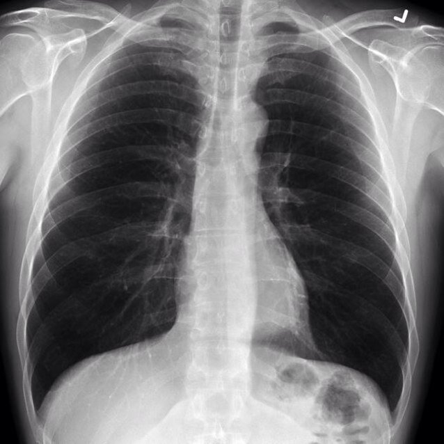 Focused on all aspects of #teleradiology and #telemedicine to improve #telehealth #healthcare #telerad #telemed