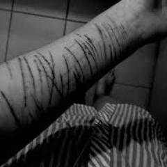 Acepto tus palabras de  me das asco . Gorda rayante ahogada en un mar de lagrimas con mente suicida. Deseo mi muerte.
