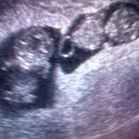 Dad in Training (@dadtobeadvice) Twitter profile photo
