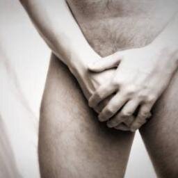 Penile melanoma is a rare type of cancer that occurs in the skin or tissues of the penis.  Awareness of a taboo cancer on twitter by nigel smith @pogue53