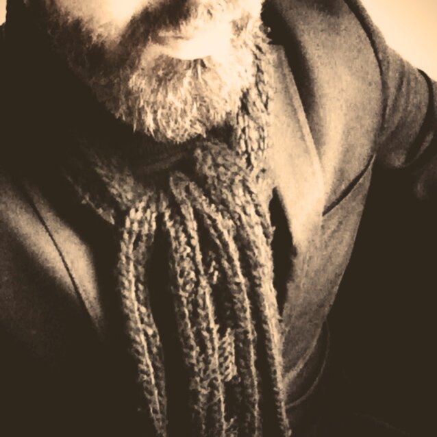 opinions are like as.h.l.s, we all got one.. bowie fan, love russian fever & raw food