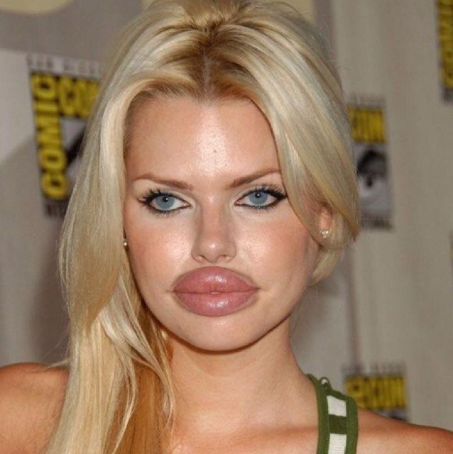 The nation of duckfaces