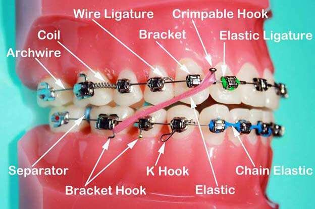 kami MEMBANTU menjawab pertanyaan dan permasalahan ANDA yang berhubungan dengan perawatan orthodonti/behel/kawat gigi