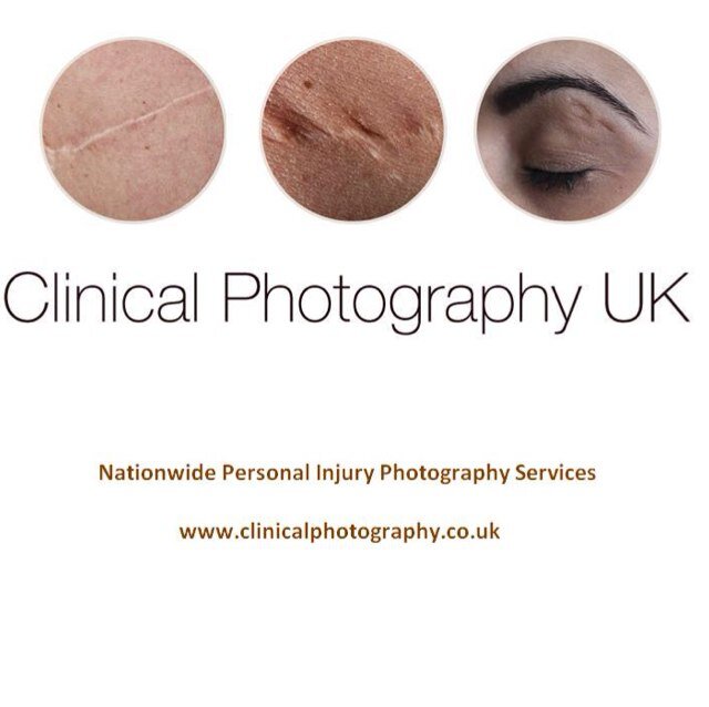 UK wide personal injury photography by expert qualified clinical photographers under the supervision of Tim Zoltie BA(hons) PgC RMIP LBIPP MIMI (@timzoltie)