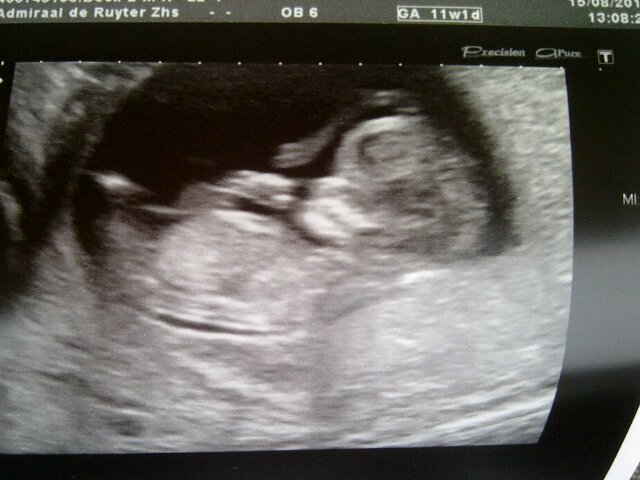 Lovee my boy! Bby on his/her way.. Happyy!!