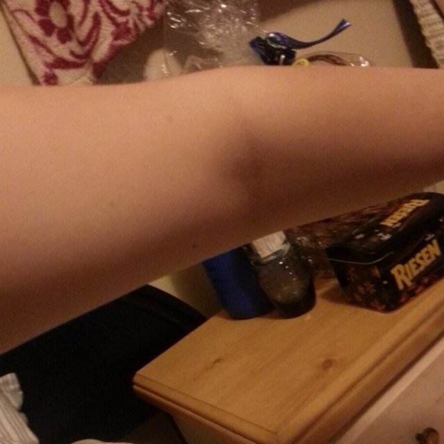 hi hailee's arm here
