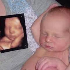 1800 Sonogram is a 3D ultrasound 4D ultrasound free locating service that helps you find 3d ultrasound and 4d ultrasound centers nationwide.