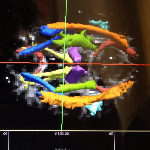 Brazilian Blog on Medical Physics