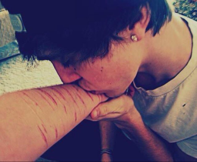 Anorexia • Bulimia • EDNOS • Self Harm • Cutting• Burning • Depression •. Bi Polar • Hope• Recovery•.