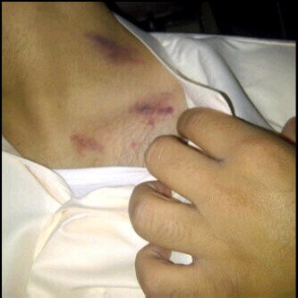 PIN:2B25FDD7