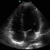 UKCOM Ultrasound (@ukcomultrasound) Twitter profile photo UKCOM Ultrasound (@ukcomultrasound) Twitter profile photo