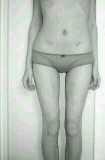 #13. Bulimica. Soñando con un cuerpo perfecto.