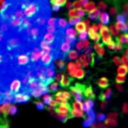 Chlamydia, cytoskeleton dynamics; chlamydial stress responses; fibrosis. UCLA MIMG, UW-Madison McArdle Lab, NIAID/RML.