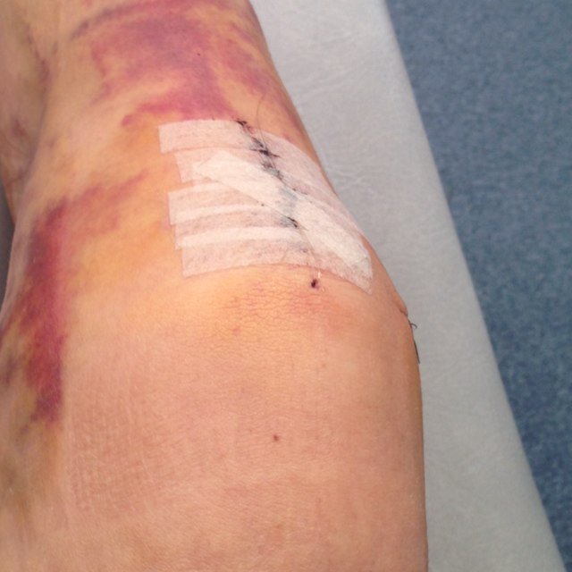 thatACLgirl's profile picture. Doing everything I can to get back on the soccer field // 16 // Joshua 1:9