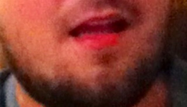 Just a young beard trying to make the best out of a hairy situation