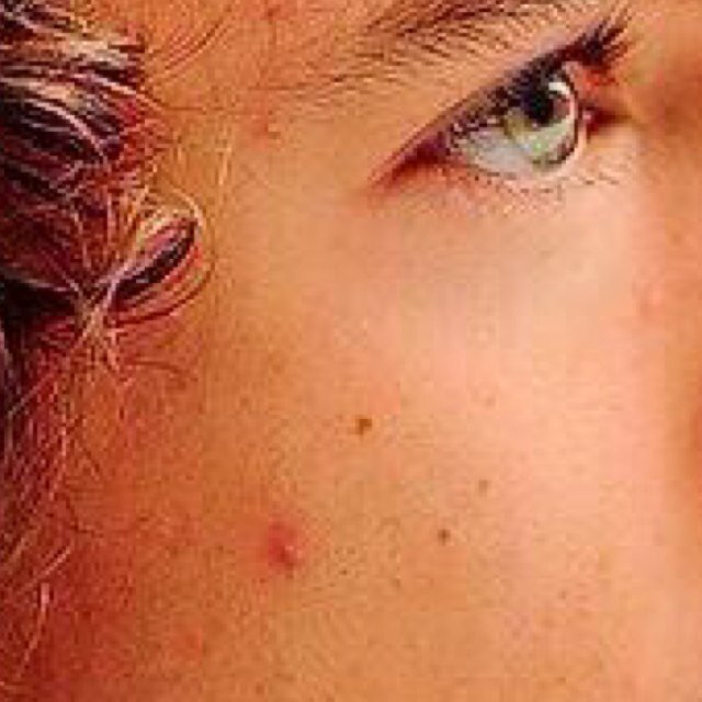 @fluffharry @zouisfix