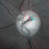 Patrick Richardson (@opticalbod) 's Twitter Profile