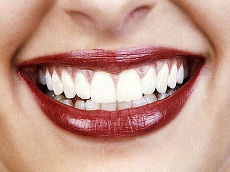 Specialise in teeth-whitening & making your teeth shine with happiness xo