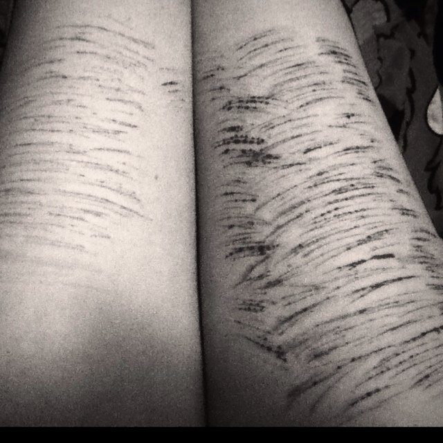 So much too escape from, but no where too escape...
