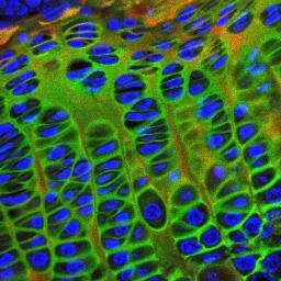 Systems biology for the functional validation of genetic determinants of skeletal diseases