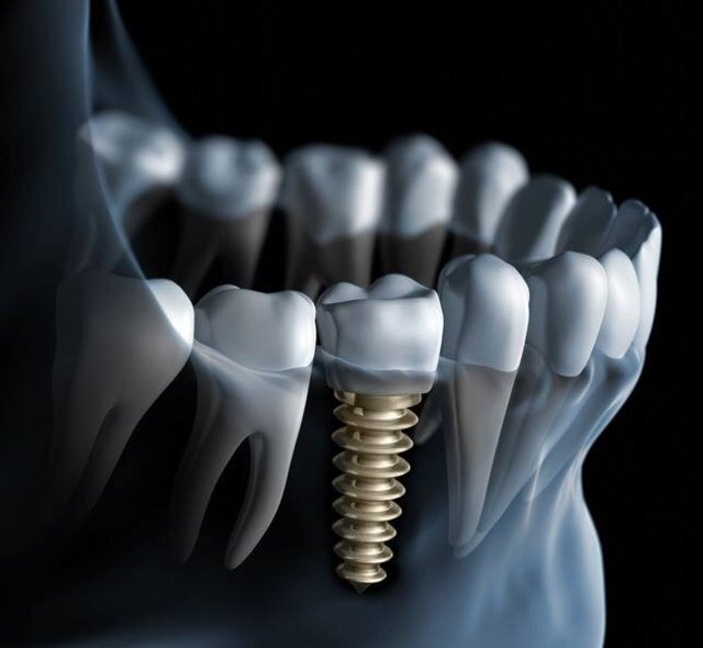 Ortodoncia y Odontologia Integral (pronto implantes dentales)