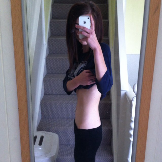 height: 5'7 CW:52kg I was 47kg before I started eating again GW:45kg