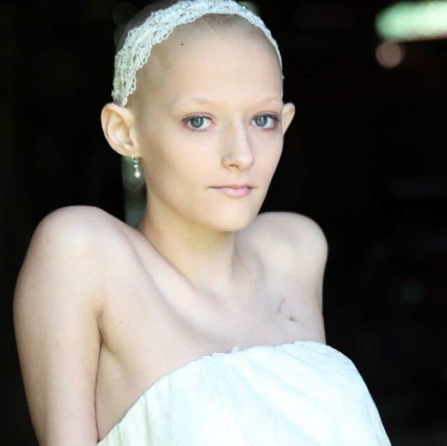 Pray for Beth!