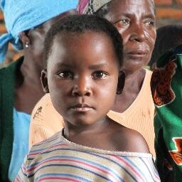 Fighting against Severe Acute Malnutrition in Malawi, Africa