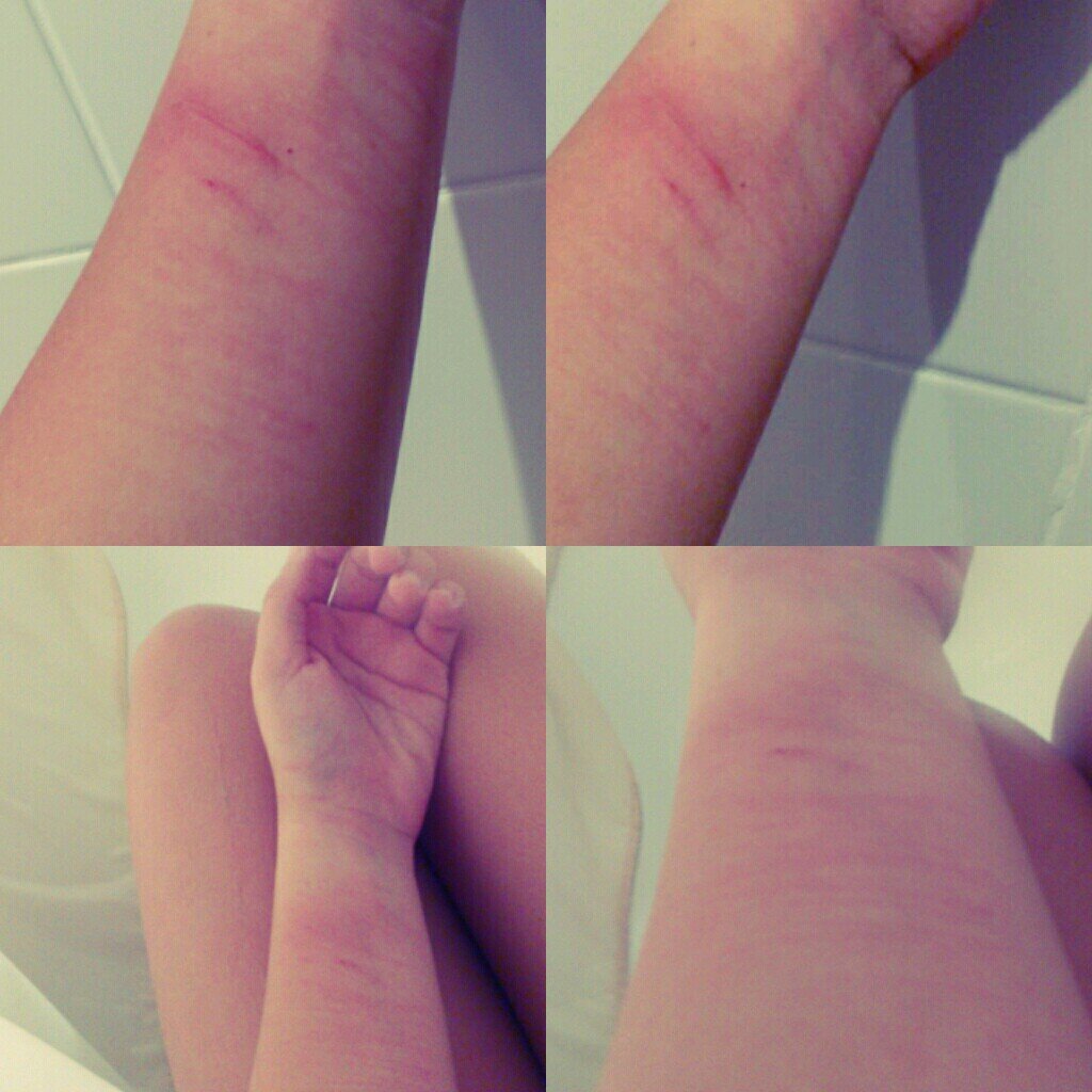 LabiosRajados's profile picture. Ni Ana&Mia ni mierdas, estamos enfermas. Nunca agusto. 51k