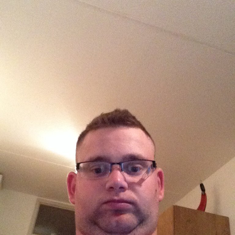 Louis. Dwarsleasie patient door ongeluk!