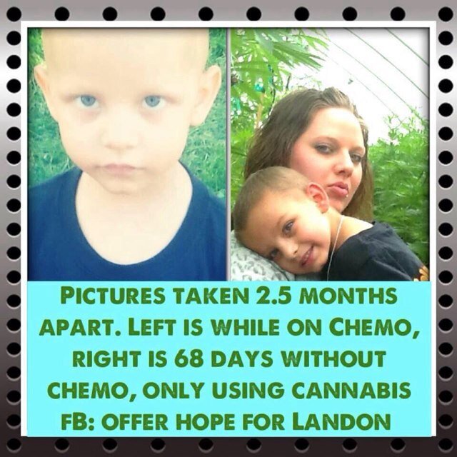 Official Hope for Landon Twitter. Help a young child fight Leukemia with cannbis!