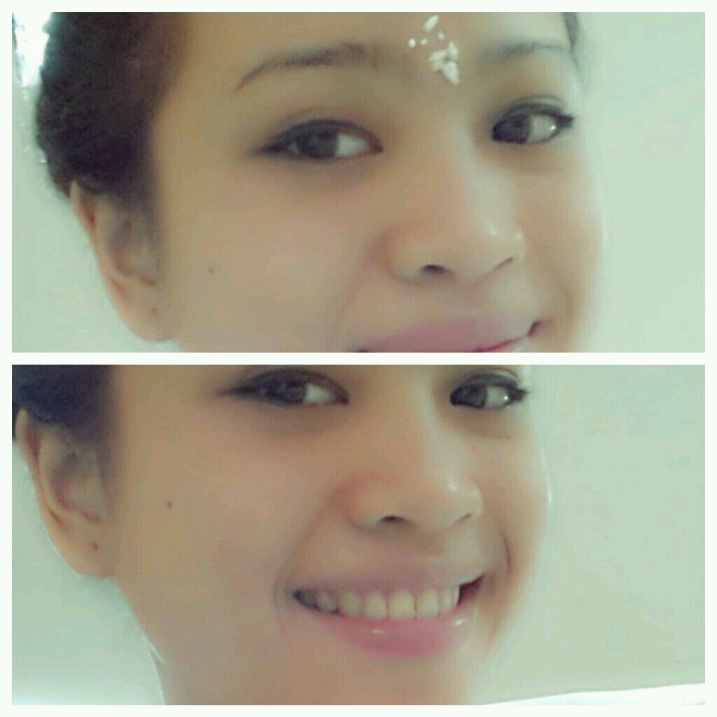 yuca_kxk's profile picture. Faculty of nursing . @ stikes wiramedika ppni bali .