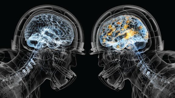 This Account is to promote awareness and increase support for an invisible injury. Concussions are a SERIOUS life threatening injury