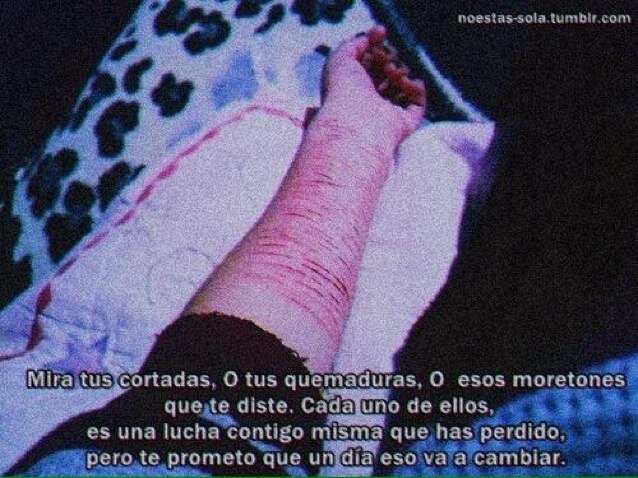 Odio todo esto.. 
Solo quiero morirme y ya.