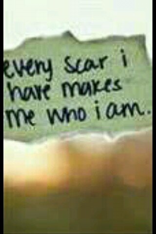 im_brokenx's profile picture. Carrying the weight of the world on my shoulders. Im hiding behind a smile. When you hit rock bottom,the only way is up.x