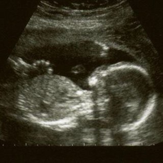 Jenny 27. Proud mummy and nurse. Anorexic and struggling... Tweets from a women lost in the world