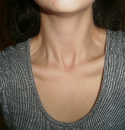 I was thin once, now I'm a fat cow. Pro Ana and pro mia. Sophomore Year. Studying PolSci. Mx. Goal:48kg.