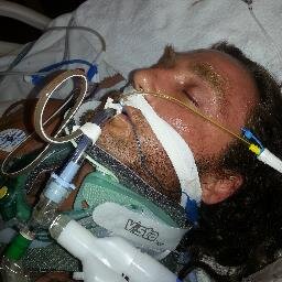 I was in an ATV accident due to faulty ATV, in a coma & on life support, Crushed ribs, broken skull & spine, Traumatic Brain Injury, PTSD, seizures, anxiety