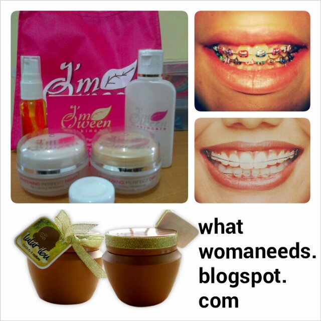 Behel gigi, I'M QWEEN skincare, Agen LULUR IBU A1/EB/AB/LI 089607777664/ 2AC685EA